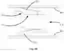 Fig. 04 - Device for fixing equipment to an end of the inner surface of a tube