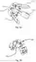 Fig. 05 - Device for fixing equipment to an end of the inner surface of a tube