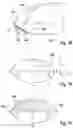 Fig. 10 - Headlight lens for a vehicle headlight