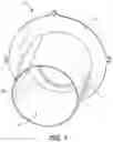 Fig. 02 - Gas burner systems and methods for calibrating gas burner systems