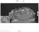 Fig. 14 - Real-time display method, device, system and storage medium of three-dimensional point cloud
