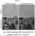 Fig. 11 - Real-time quantification method of cell viability through supravital dye uptake using lens-free imaging system
