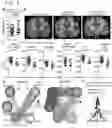 Fig. 05 - COMPOSITIONS AND METHODS FOR CHARACTERIZING AND TREATING ALZHEIMERS DISEASE