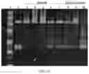Fig. 08 - EVALUATION AND TREATMENT OF BRADYKININ-MEDIATED DISORDERS