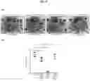 Fig. 24 - BIOMARKER WITH THERAPEUTIC IMPLICATIONS FOR PERITONEAL CARCINOMATOSIS