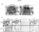 Fig. 25 - BIOMARKER WITH THERAPEUTIC IMPLICATIONS FOR PERITONEAL CARCINOMATOSIS