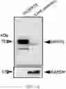 Fig. 02 - METHOD OF DETECTING, DETERMINING, AND TREATING HEAT STRESS BASED ON EXPRESSION OF GRP75 IN AVIAN SPECIES
