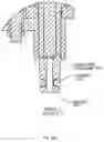 Fig. 78 - SYSTEMS AND METHODS FOR MULTI-ANALYSIS