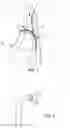 Fig. 02 - METHOD FOR DESIGNING AND VALIDATING THE SHAPE AND POSITIONING OF A CANNULA FOR A PATIENT BY SIMULATING THE INSERTION INTO THE TRACHEA