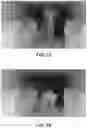 Fig. 06 - Motion identification method and system