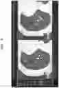 Fig. 07 - Medical image reconstruction apparatus and method for screening for plurality of types of lung diseases