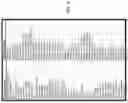 Fig. 04 - CYTOLOGICAL ANALYSIS OF NUCLEAR NEAT-1 EXPRESSION FOR DETECTION OF CHOLANGIOCARCINOMA