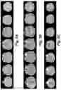 Fig. 06 - Method for detecting radiological progression in cancer surveillance