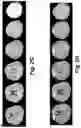 Fig. 08 - Method for detecting radiological progression in cancer surveillance
