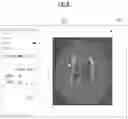 Fig. 09 - Method for detecting white matter lesions based on medical image