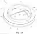 Fig. 02 - Mitral valve annular dilation devices and methods for use