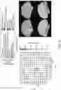 Fig. 10 - MULTIMODAL BIOMARKERS PREDICTIVE OF TRANSDIAGNOSTIC SYMPTOM SEVERITY