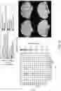 Fig. 12 - MULTIMODAL BIOMARKERS PREDICTIVE OF TRANSDIAGNOSTIC SYMPTOM SEVERITY