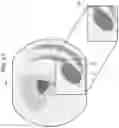 Fig. 22 - Medical image processing system and operation method therefor