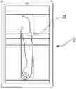 Fig. 01 - Health System and Apparatus and Method of Use Thereof