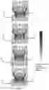 Fig. 06 - METHOD AND SYSTEM FOR PATIENT-SPECIFIC PREDICTING OF CYCLIC LOADING FAILURE OF A CARDIAC IMPLANT