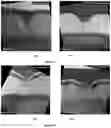 Fig. 08 - Method of manipulating deposition rates of poly-silicon and method of manufacturing a SiGe HBT device