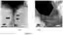 Fig. 09 - Method of manipulating deposition rates of poly-silicon and method of manufacturing a SiGe HBT device