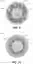 Fig. 06 - Scaffolding matrix with internal nanoparticles