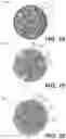 Fig. 08 - Scaffolding matrix with internal nanoparticles