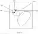 Fig. 14 - System and method for processing three dimensional images