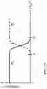 Fig. 14 - Dual-microphone with wind noise suppression method