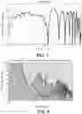 Fig. 09 - Loudspeaker with reduced audio coloration caused by reflections from a surface