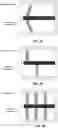Fig. 15 - Microphone and electronic device having the same