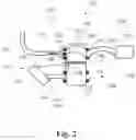 Fig. 03 - Hearing device earpiece having intermediate module