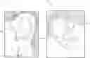 Fig. 01 - Hearing device cable