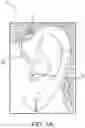 Fig. 02 - Hearing device cable