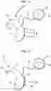 Fig. 02 - Hearing prosthesis system having interchangeable housings