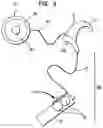 Fig. 03 - Hearing prosthesis system having interchangeable housings