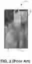Fig. 04 - Devices, Systems, and Methods for Seed Trench Protection