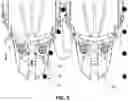 Fig. 06 - Corn Harvester Header
