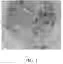 Fig. 02 - TREE EGGPLANT AND CULTIVATION METHOD, RAPID PROPAGATION METHOD AND APPLICATION THEREOF
