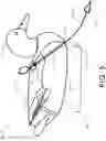 Fig. 06 - Quik-Pik Decoy