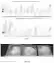 Fig. 03 - CHEESE AND YOGURT LIKE COMPOSITIONS AND RELATED METHODS