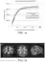 Fig. 03 - Nutritional composition and infant formula for promoting myelination of the brain