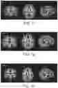 Fig. 05 - Nutritional composition and infant formula for promoting myelination of the brain