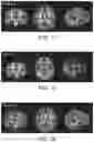 Fig. 06 - Nutritional composition and infant formula for promoting myelination of the brain