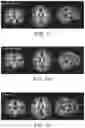 Fig. 07 - Nutritional composition and infant formula for promoting myelination of the brain