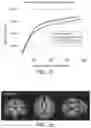 Fig. 03 - Nutritional composition and infant formula for promoting de novo myelination