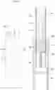 Fig. 06 - Gel Aerosol-Forming Substrate Cartridge that Can be inserted into Electrically Heated Smoking Article, Electrically Heated Smoking Article Including the Same, and Aerosol Generating Device and System Therefor