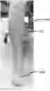 Fig. 01 - Active knit compression garments, devices and related methods
